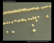 mueller hinton agar staphylococcus aureus